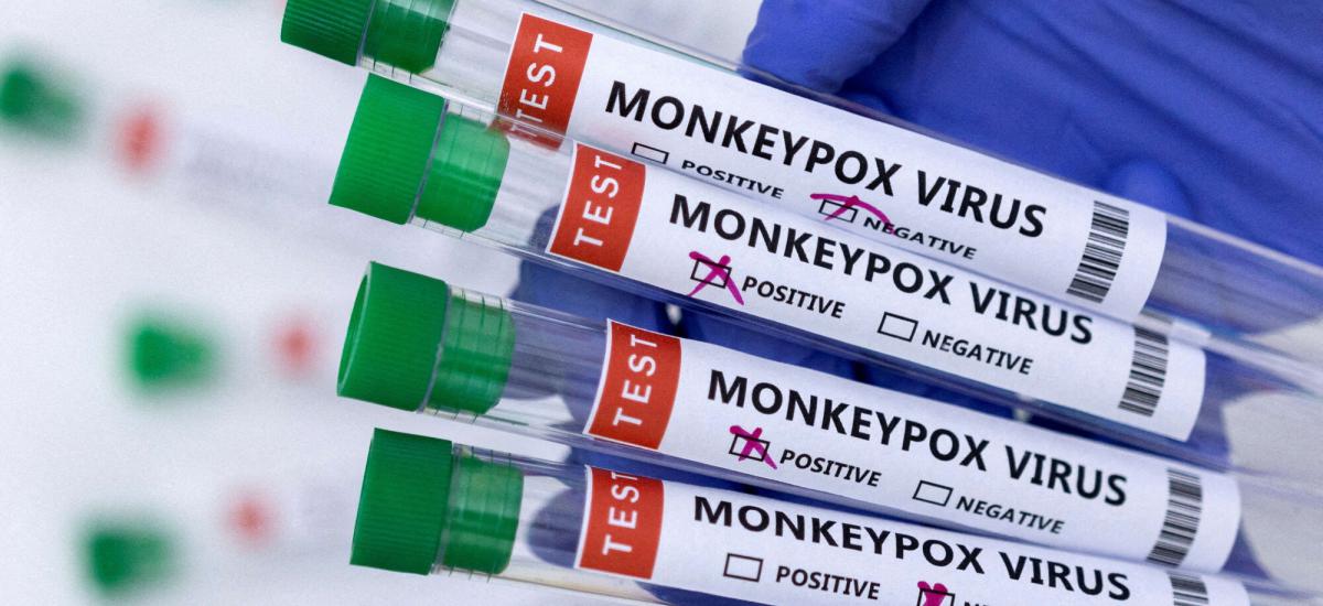 monkeypox-turquia-relata-primeiro-caso-variola-do-macaco